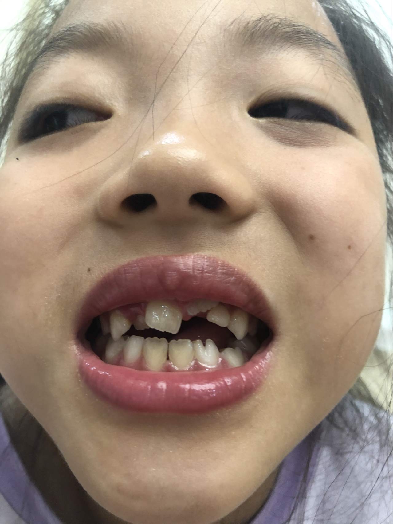 莊最新牙齒技術(shù)揭秘，牙齒美容新選擇